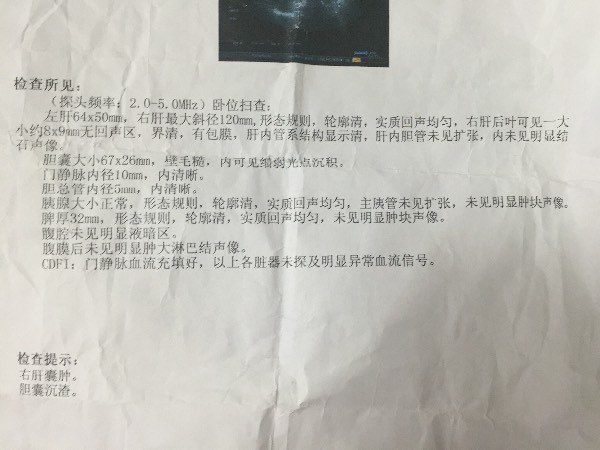 肝囊肿需要治疗吗，05cm肝囊肿需要治疗吗